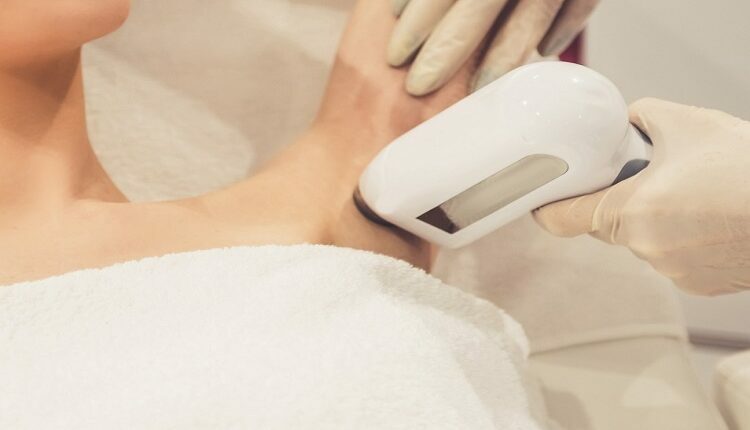 Laser Hair Removal