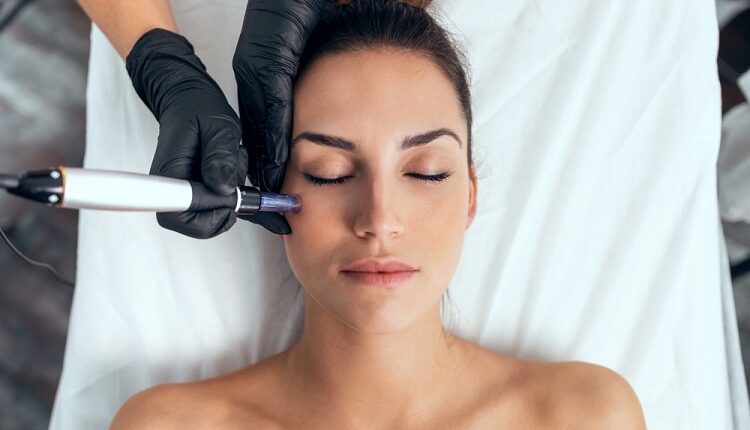 Microneedling in Glendale
