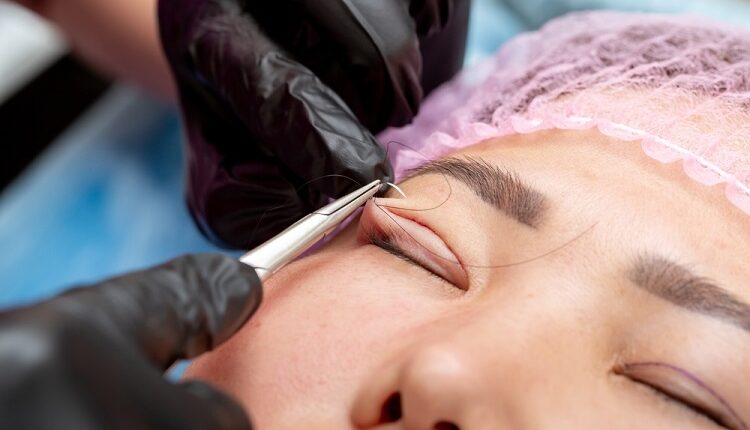 Ptosis in Peoria